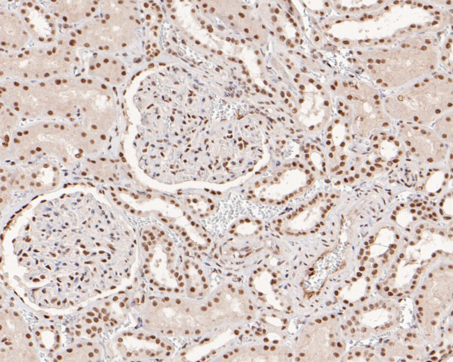 MSH2 Antibody in Immunohistochemistry (Paraffin) (IHC (P))