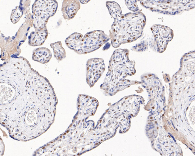 MSH2 Antibody in Immunohistochemistry (Paraffin) (IHC (P))