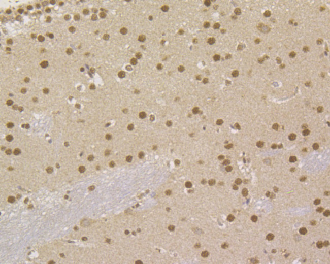 MSH2 Antibody in Immunohistochemistry (Paraffin) (IHC (P))