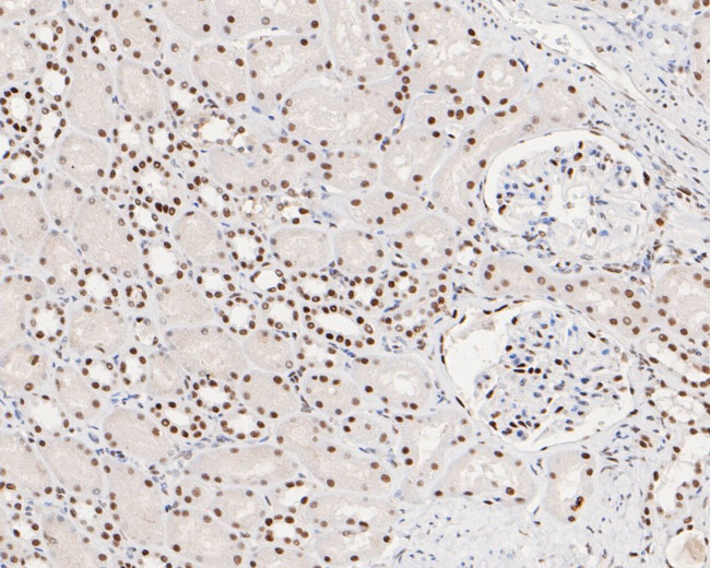 MSH2 Antibody in Immunohistochemistry (Paraffin) (IHC (P))