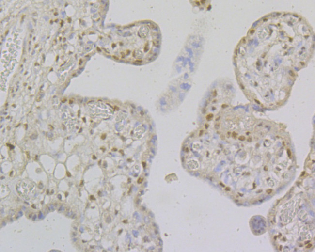 MSH2 Antibody in Immunohistochemistry (Paraffin) (IHC (P))