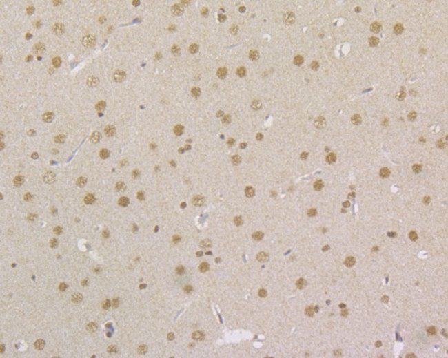 MSH2 Antibody in Immunohistochemistry (Paraffin) (IHC (P))