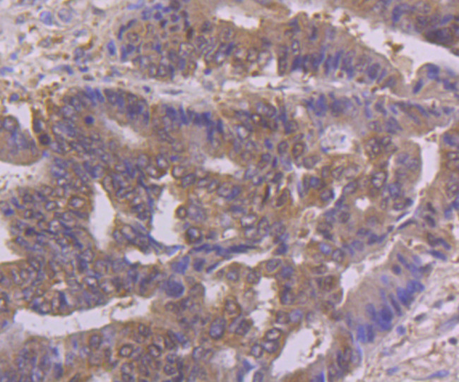 NFIB Antibody in Immunohistochemistry (Paraffin) (IHC (P))