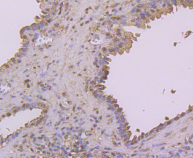 NFIB Antibody in Immunohistochemistry (Paraffin) (IHC (P))