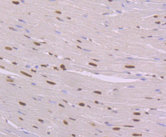 NFIB Antibody in Immunohistochemistry (Paraffin) (IHC (P))