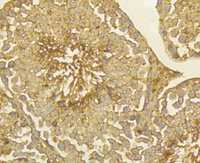 PGF Antibody in Immunohistochemistry (Paraffin) (IHC (P))