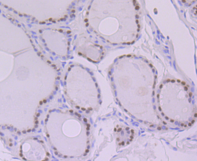 PAX8 Antibody in Immunohistochemistry (Paraffin) (IHC (P))