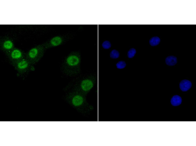 PTBP1 Antibody in Immunocytochemistry (ICC/IF)