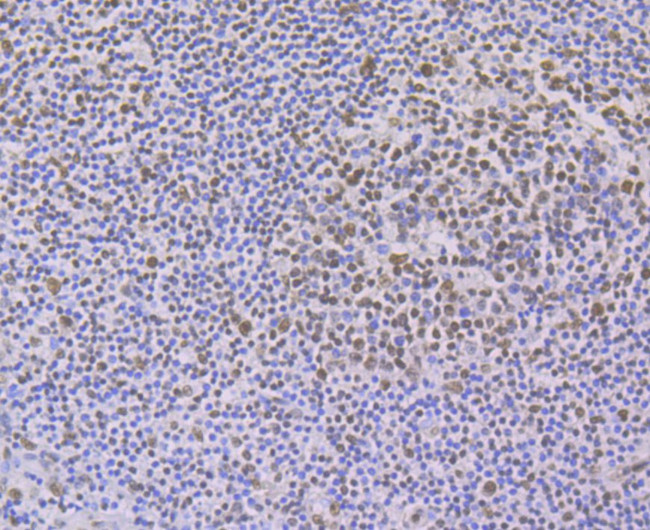 PTBP1 Antibody in Immunohistochemistry (Paraffin) (IHC (P))