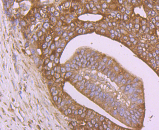 Calreticulin Antibody in Immunohistochemistry (Paraffin) (IHC (P))