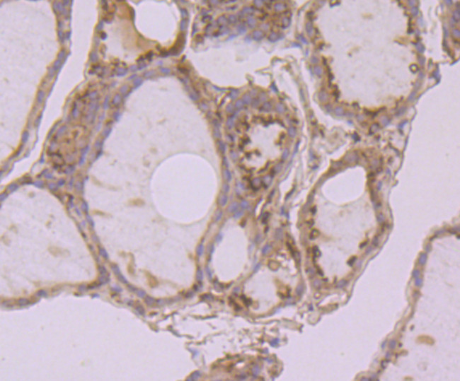 Calreticulin Antibody in Immunohistochemistry (Paraffin) (IHC (P))