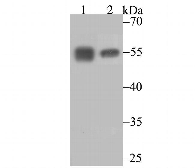 Calreticulin Antibody in Western Blot (WB)