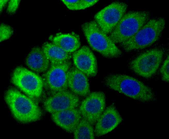 Calreticulin Antibody in Immunocytochemistry (ICC/IF)