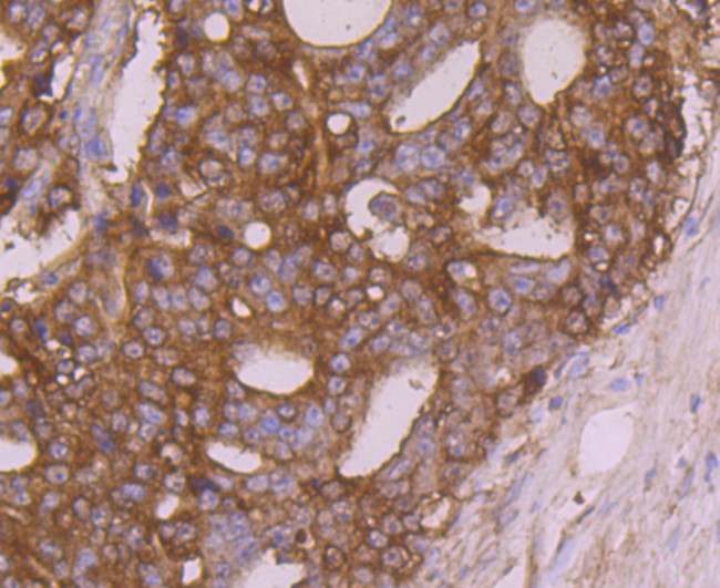 Calreticulin Antibody in Immunohistochemistry (Paraffin) (IHC (P))