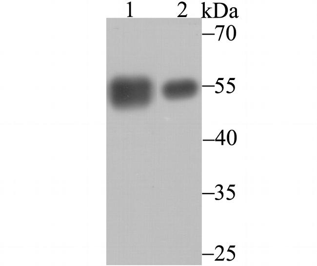 Calreticulin Antibody in Western Blot (WB)