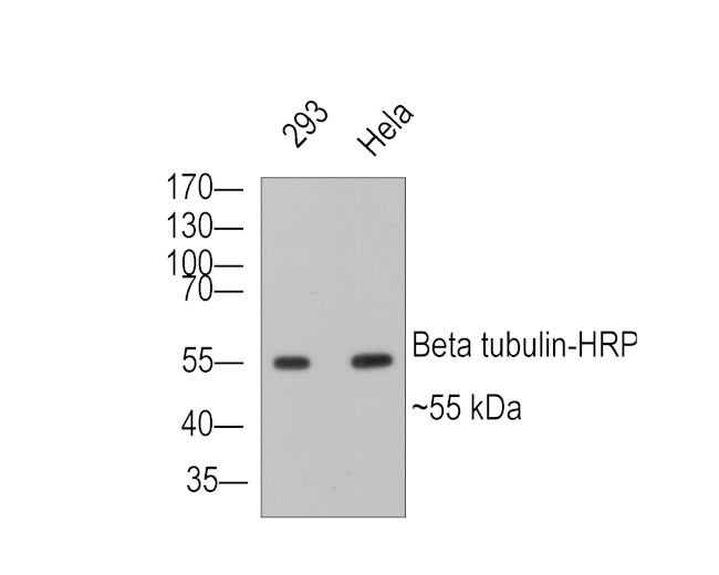 beta Tubulin Antibody in Immunohistochemistry (Paraffin) (IHC (P))