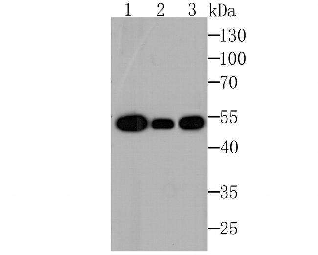 beta Tubulin Antibody in Western Blot (WB)