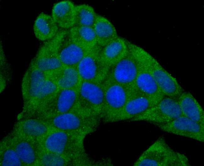 IL-6 Antibody in Immunocytochemistry (ICC/IF)