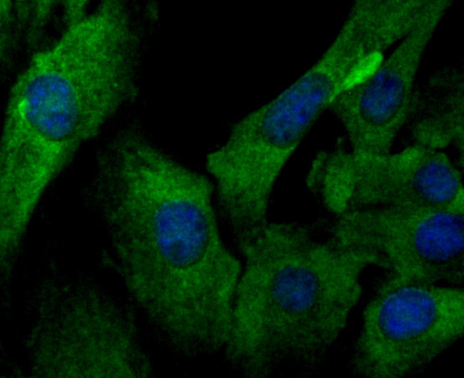 IL-6 Antibody in Immunocytochemistry (ICC/IF)