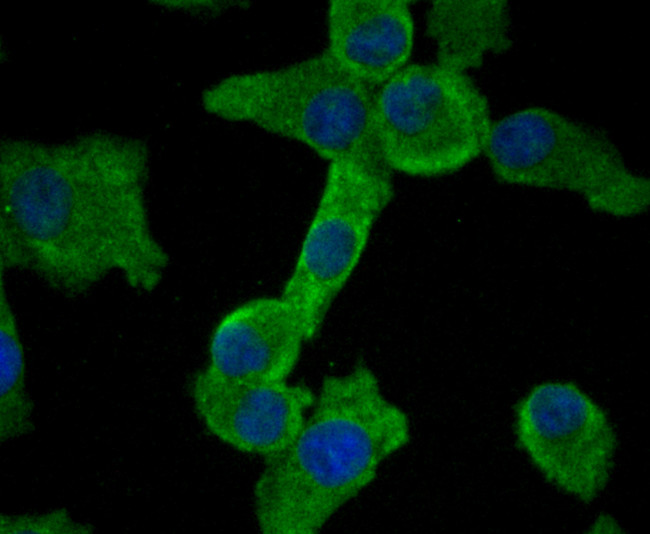 SMAD2 Antibody in Immunocytochemistry (ICC/IF)