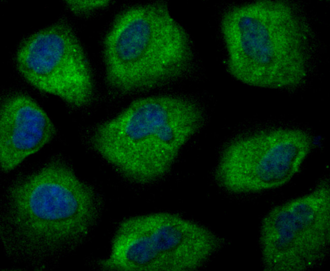 SMAD2 Antibody in Immunocytochemistry (ICC/IF)