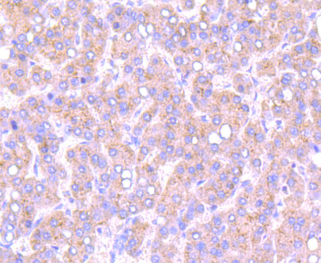 SMAD2 Antibody in Immunohistochemistry (Paraffin) (IHC (P))