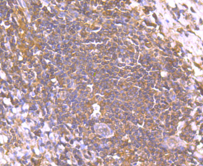 SMAD2 Antibody in Immunohistochemistry (Paraffin) (IHC (P))