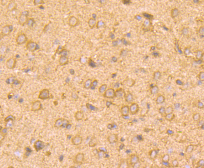 SMAD2 Antibody in Immunohistochemistry (Paraffin) (IHC (P))