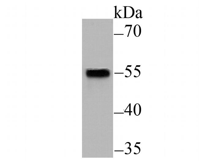 SMAD2 Antibody in Western Blot (WB)