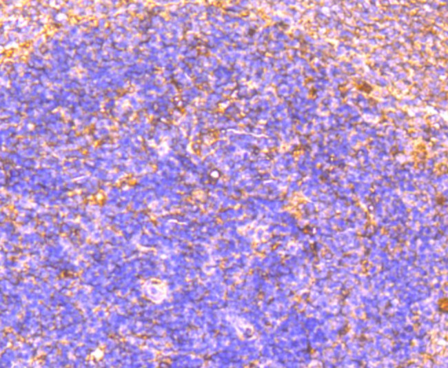 OX40 (CD134) Antibody in Immunohistochemistry (Paraffin) (IHC (P))