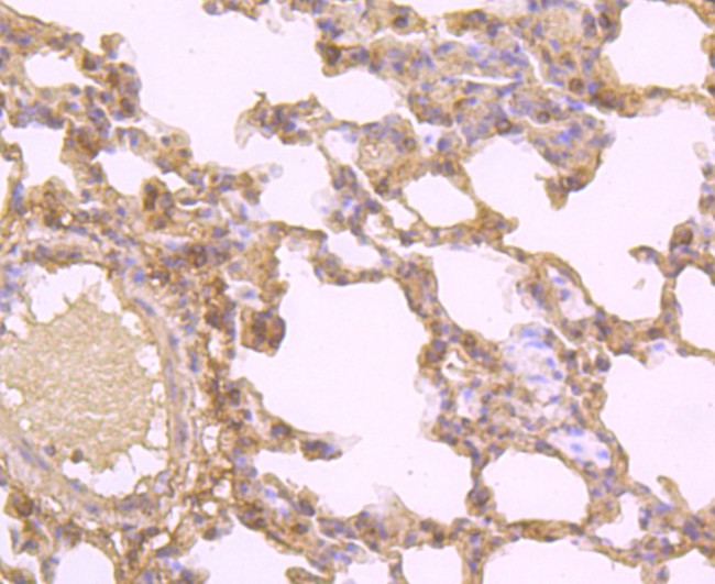 OX40 (CD134) Antibody in Immunohistochemistry (Paraffin) (IHC (P))