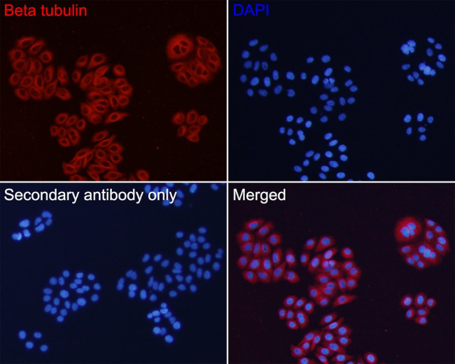 beta Tubulin Antibody in Immunocytochemistry (ICC/IF)