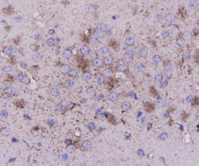 beta Tubulin Antibody in Immunohistochemistry (Paraffin) (IHC (P))