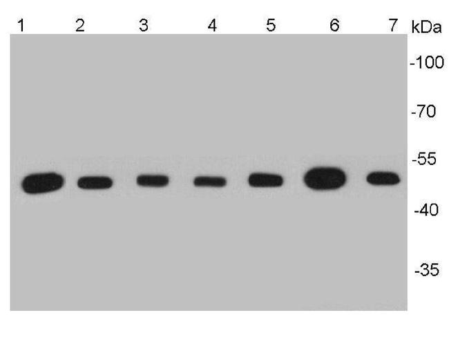 beta Tubulin Antibody in Western Blot (WB)