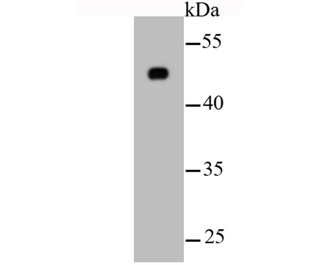 beta Tubulin Antibody in Western Blot (WB)