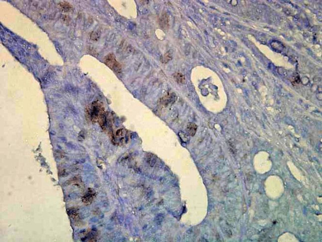 HSP70 Antibody in Immunohistochemistry (PFA fixed) (IHC (PFA))