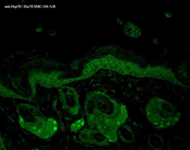 HSP70/HSC70 Antibody in Immunohistochemistry (Paraffin) (IHC (P))