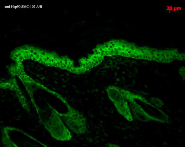 HSP90 Antibody in Immunohistochemistry (Paraffin) (IHC (P))