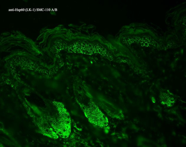 HSP60 Antibody in Immunohistochemistry (Paraffin) (IHC (P))