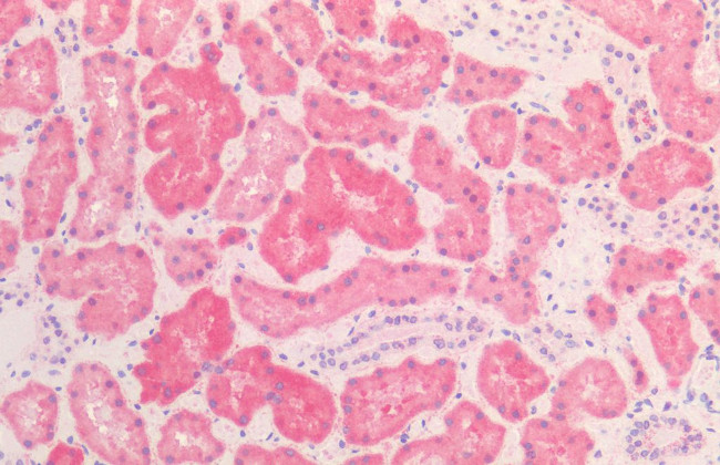 HSP60 Antibody in Immunohistochemistry (Paraffin) (IHC (P))