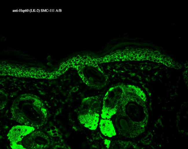 HSP60 Antibody in Immunohistochemistry (Paraffin) (IHC (P))