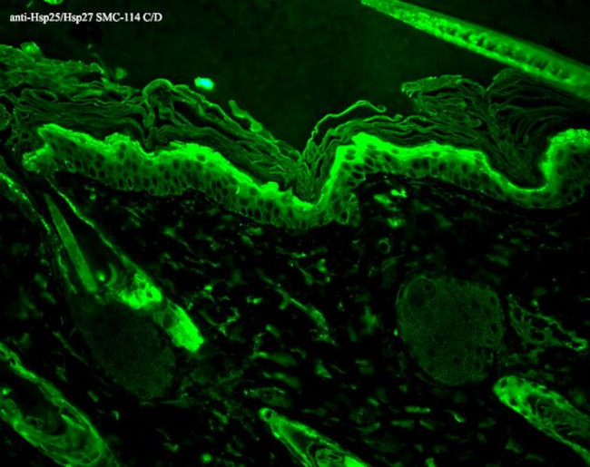 HSP27 Antibody in Immunohistochemistry (Paraffin) (IHC (P))