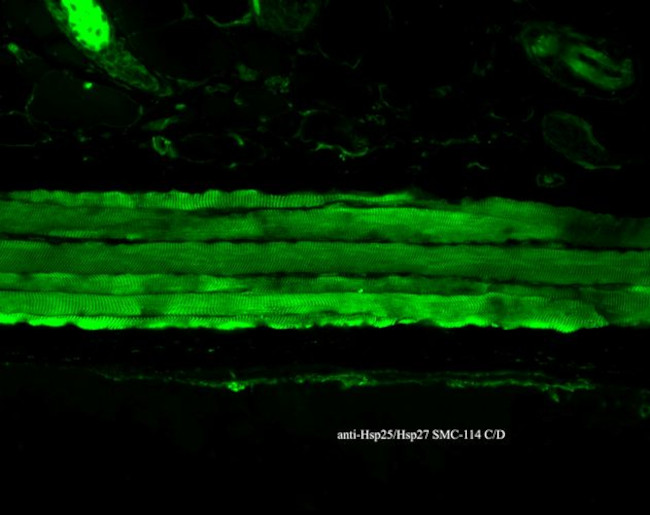 HSP27 Antibody in Immunohistochemistry (Paraffin) (IHC (P))