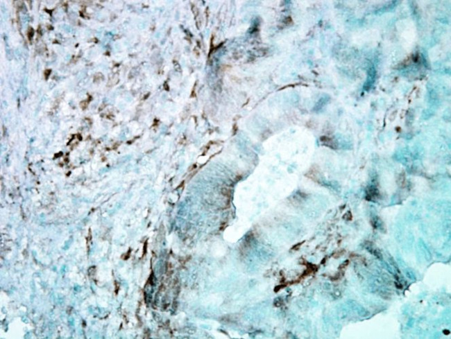 HSP27 Antibody in Immunohistochemistry (PFA fixed) (IHC (PFA))