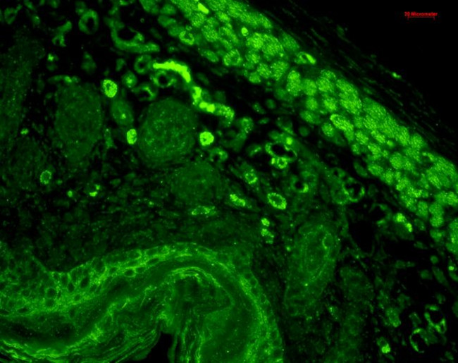 CD74 Antibody in Immunohistochemistry (Paraffin) (IHC (P))