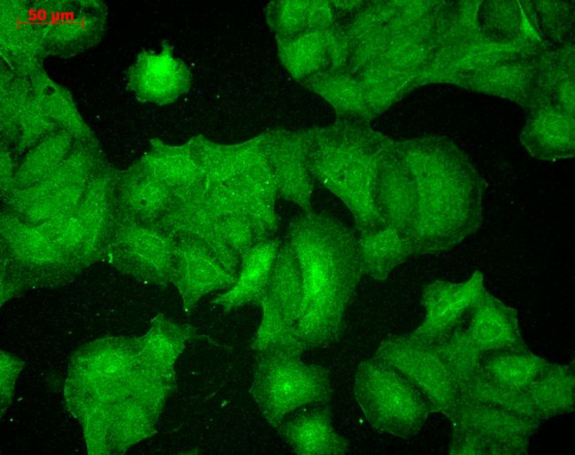 PSD-95 Antibody in Immunocytochemistry (ICC/IF)