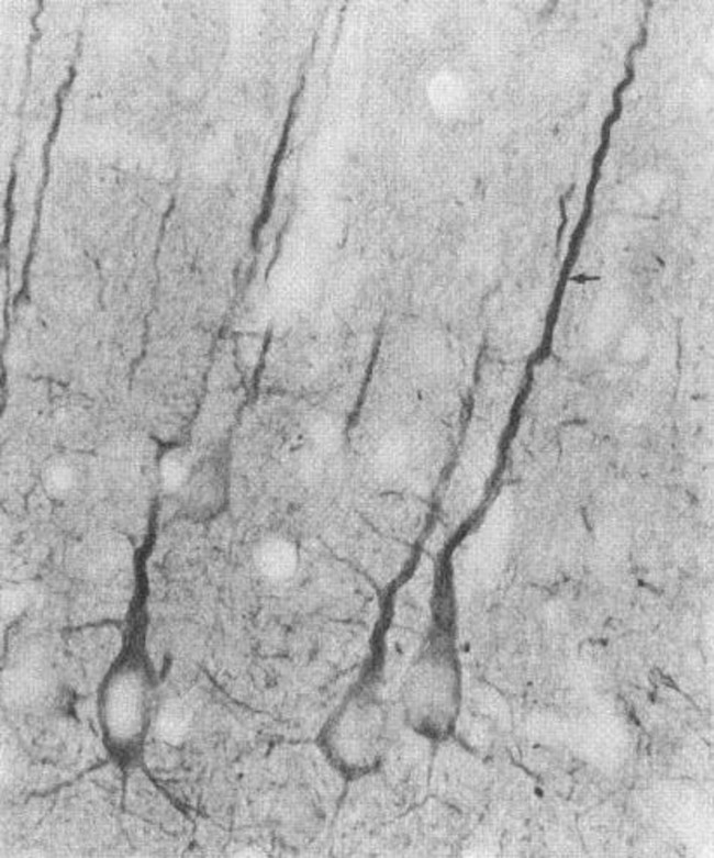 PSD-95 Antibody in Immunohistochemistry (IHC)