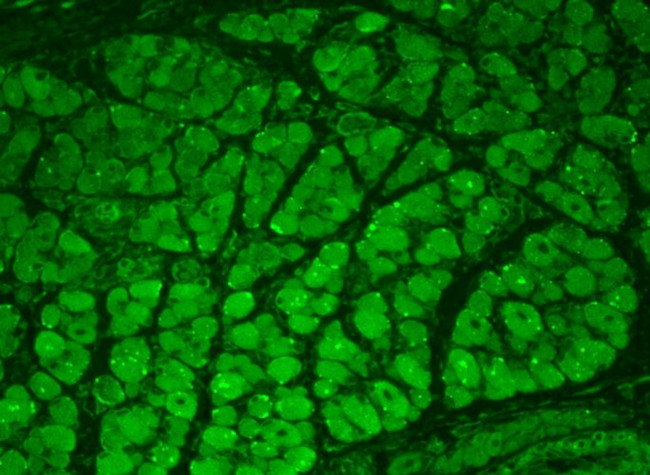 CaMKII alpha/beta Antibody in Immunohistochemistry (Paraffin) (IHC (P))