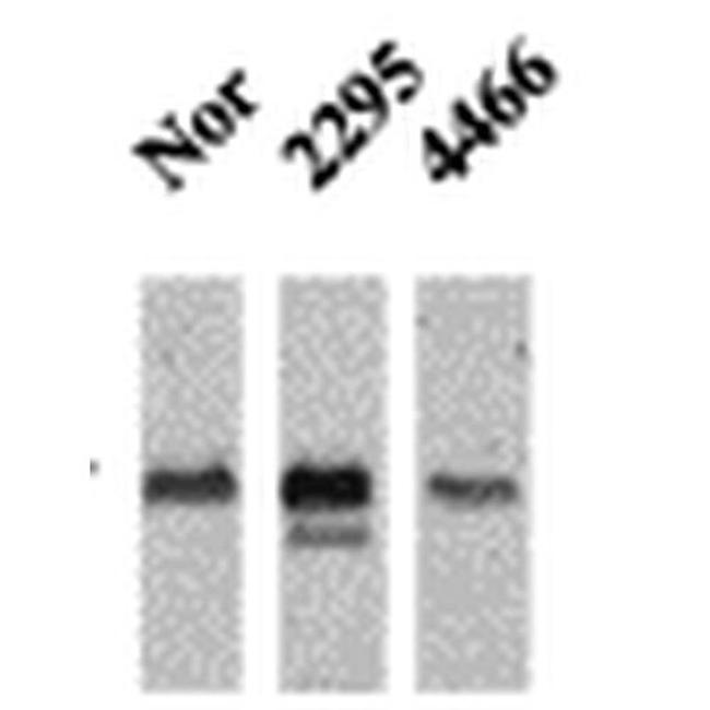 CaMKII alpha/beta Antibody in Western Blot (WB)