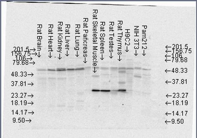 FKBP4 Antibody in Western Blot (WB)